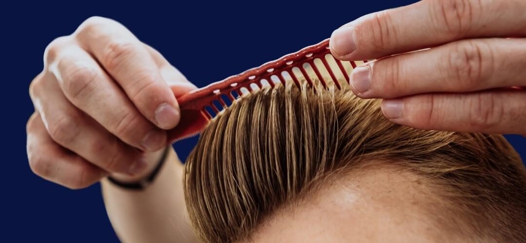 how-to-prevent-hair-loss