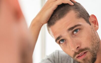 Treating Hair Loss in Your 20s
