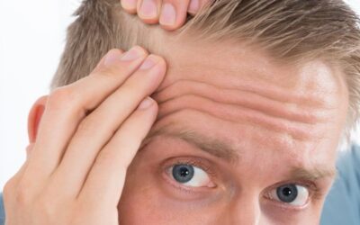 Early Signs Of Hair Loss To Look Out For
