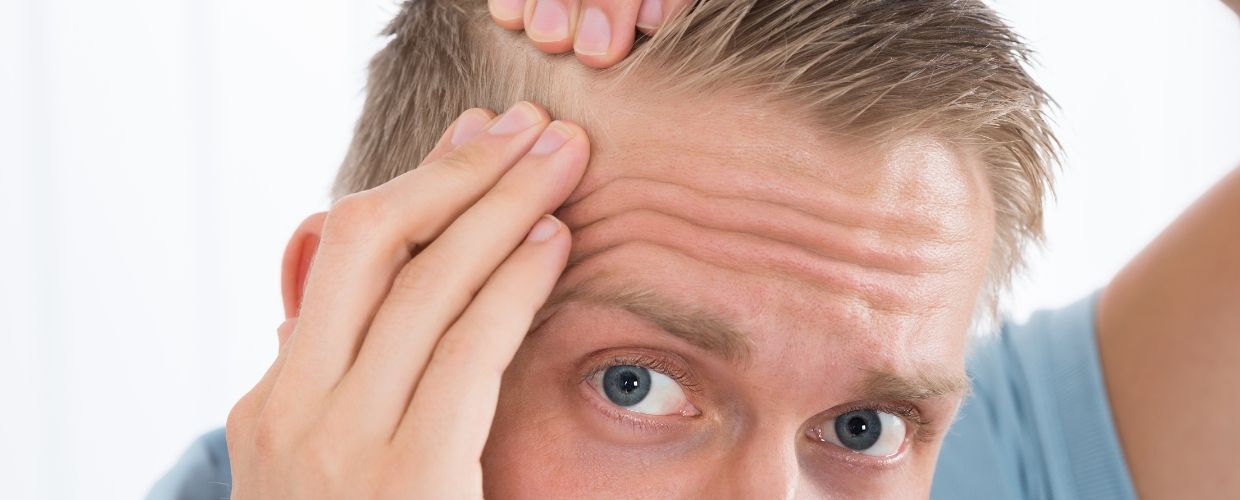 early-signs-of-hair-loss